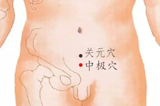 中极穴.png